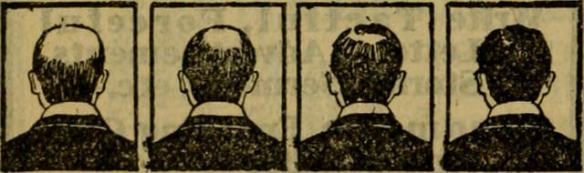 Pictures of a bald guy growing his hair back