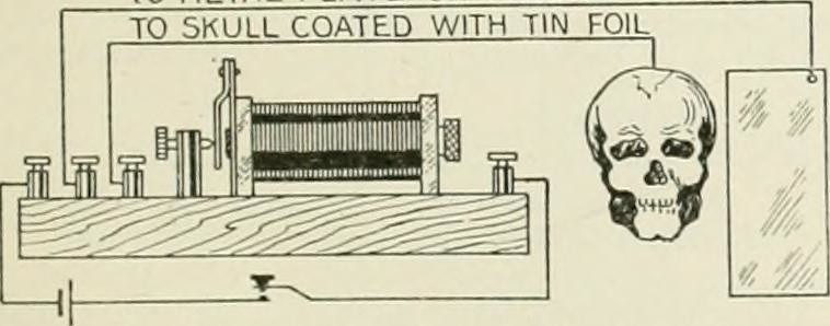 Drawing of a human skull hooked up an electrical device. It is labeled, 